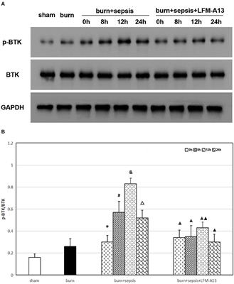 Inhibition of Bruton's Tyrosine Kinase Protects Against Burn Sepsis-Induced Intestinal Injury